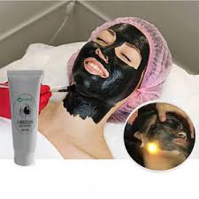 CARBON GEL FOR CARBON LASER